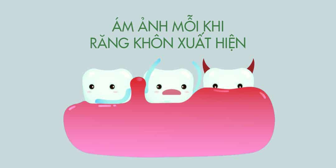 Nhổ răng khôn giá rẻ ở Thái Bình