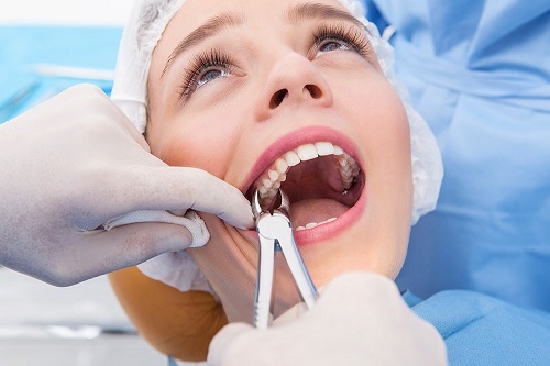 Nhổ răng khôn số 8 thành phố Thái Bình hết bao nhiêu tiền?