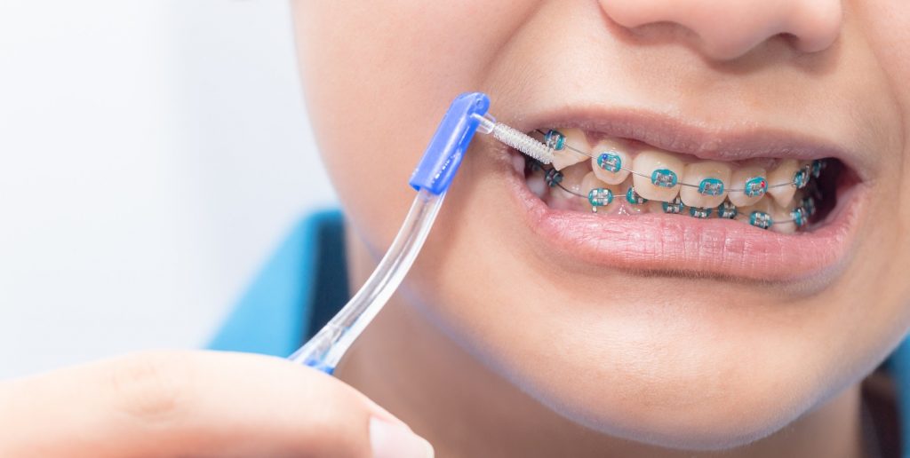 DỤNG CỤ VỆ SINH RĂNG MIỆNG MÀ AI NIỀNG RĂNG CŨNG CẦN CÓ
